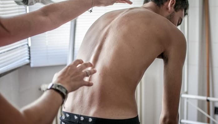 چگونه اسکولیوز تشخیص داده می‌شود؟